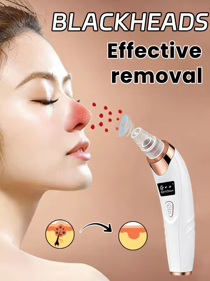 Electric Blackhead Remover Vacuum – Pore Cleaner & Facial Suction Device